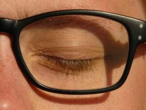 Glaukoma vizija optika